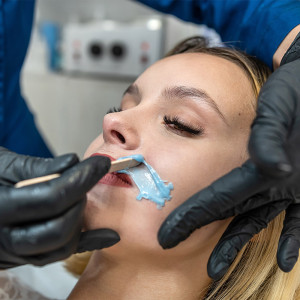 CERETTA SOPRALABIALE O ZONE VISO (MENTO/COLLO)