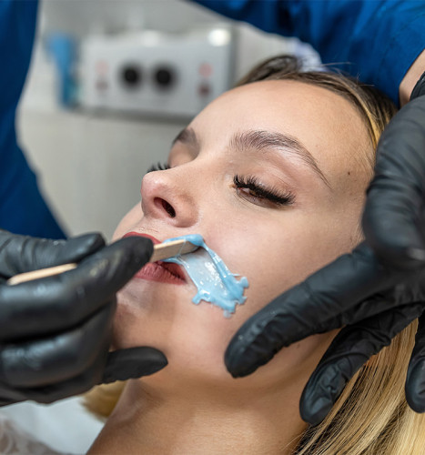 CERETTA SOPRALABIALE O ZONE VISO (MENTO/COLLO)